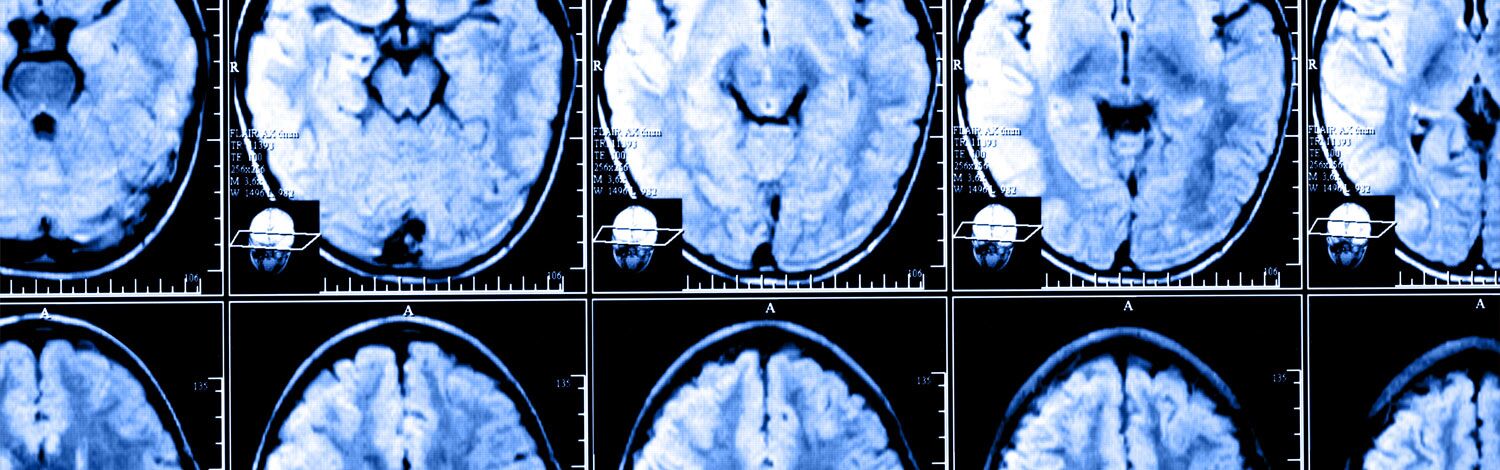 Brain Scan